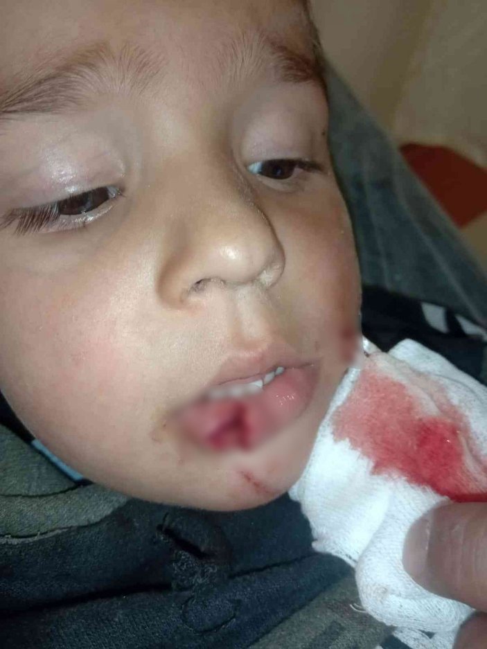 Kastamonu'da köpek saldırısına uğrayan 3 çocuktan 1'i ağır yaralı