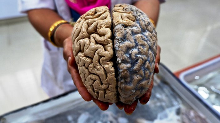 İnsanların beyni 3 bin yıl önce küçüldü