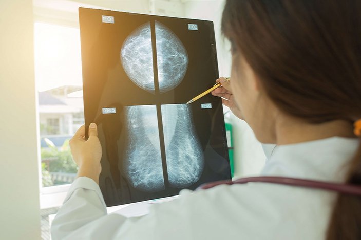Mamografi taramasını atlamak hayati risk oluşturabiliyor