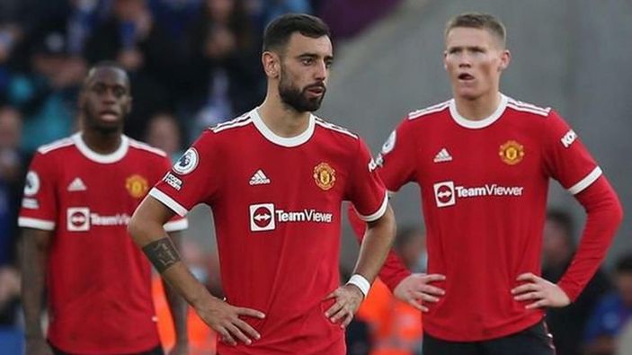 M. United taraftarı saçının dökülmesinden kulübü sorumlu tuttu