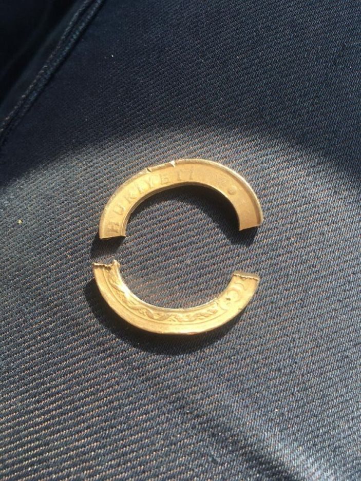 Aydın'da madeni paradan yapılan yüzük hastanelik etti