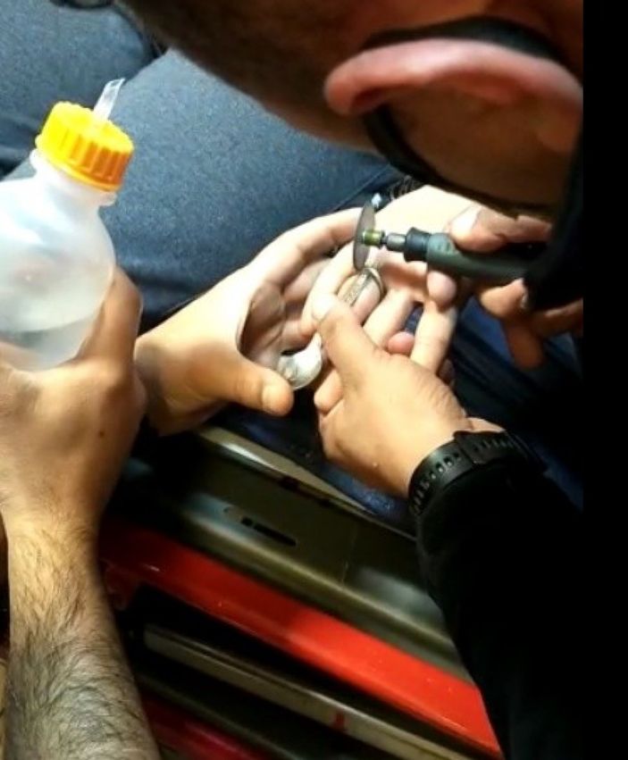 Aydın'da madeni paradan yapılan yüzük hastanelik etti