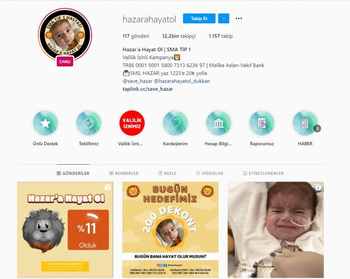 SMA hastası Hazar bebek yardım eli bekliyor