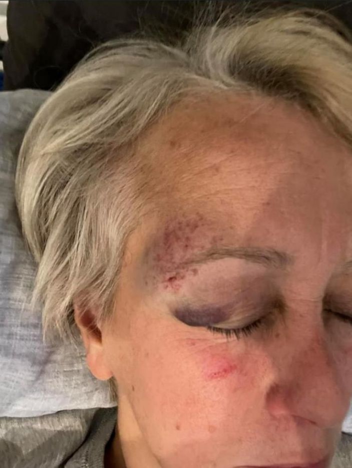 d Şanlıurfa’da Alman arkeoloğun eşi demirle dövüldü