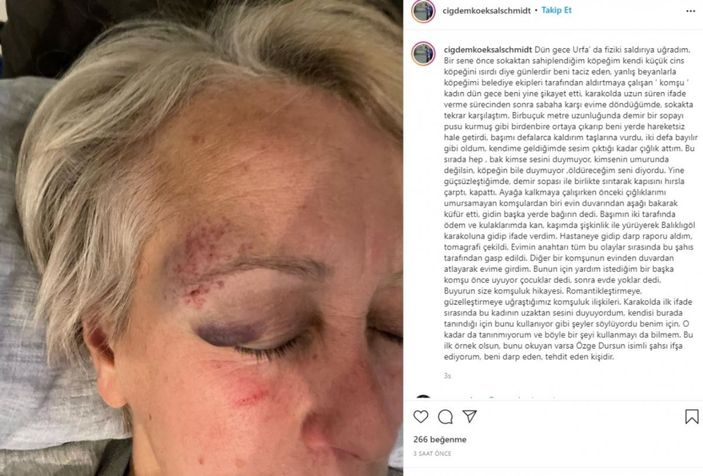 d Şanlıurfa’da Alman arkeoloğun eşi demirle dövüldü