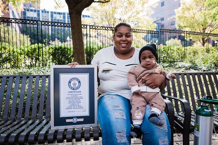 ABD’de prematüre bebek, Guinness Rekorlar Kitabı’na girdi