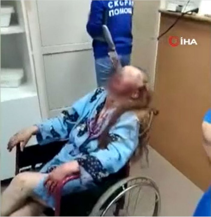 Rusya'da sarhoş koca, eşinin gözüne bıçak sapladı