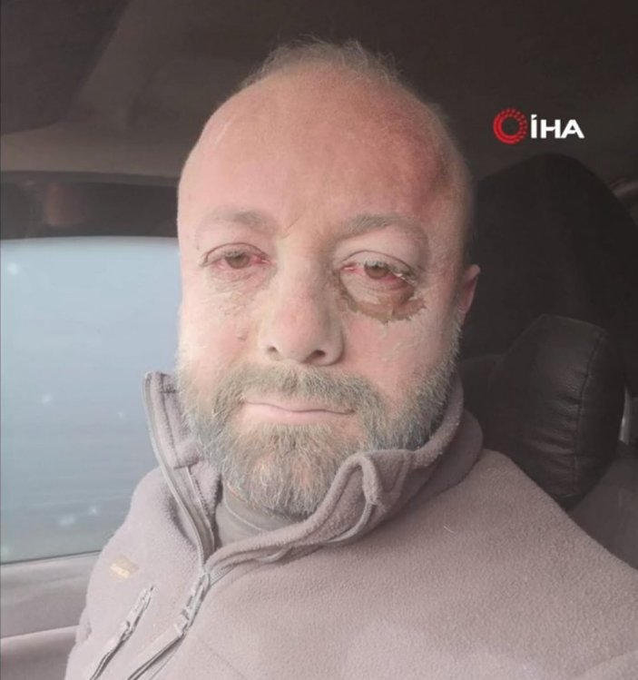 Aksaray'da kum fırtınasına yakalanan muhabir