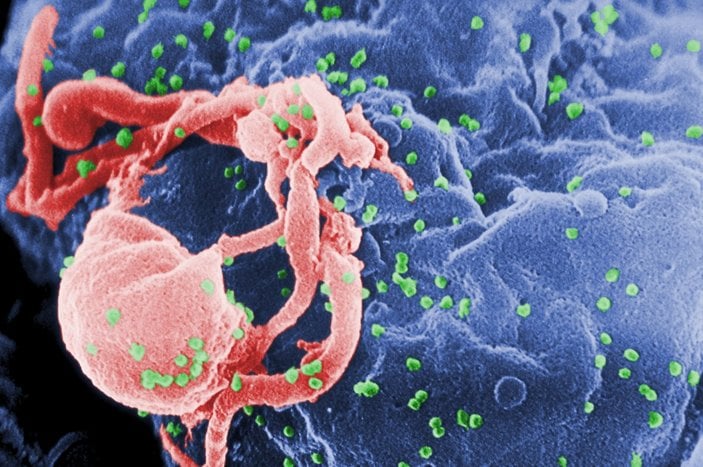 1 Aralık Dünya AIDS Günü: AIDS nedir, belirtileri nelerdir?