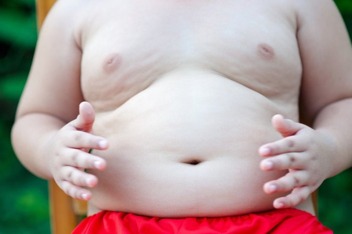Çocuklarda obezitenin sağlığa etkileri