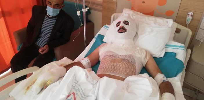 Erzincan'da tiner ile ateş yakmak isteyen gencin yüzü yandı