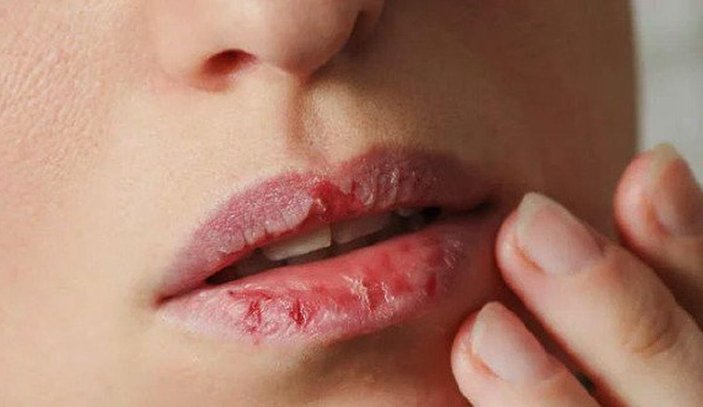 Daha çekici daha kırmızı ve daha sağlıklı dudakların sırrına: 'Merhaba'