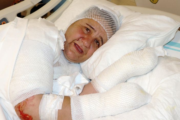 Muş’ta, ekmek pişirirken tandıra düştü