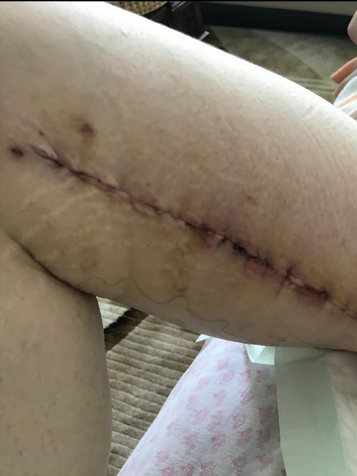 d İzmir’de 3 kez bıçak altına yatan kadın, estetik mağduru oldu