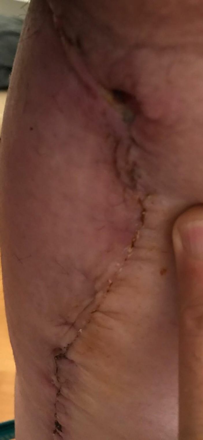 d İzmir’de 3 kez bıçak altına yatan kadın, estetik mağduru oldu