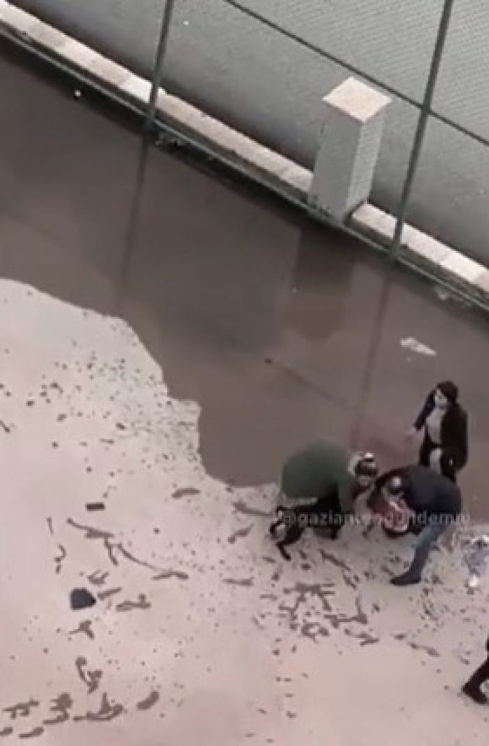 Küçük bir çocuk daha pitbull yüzünden yaşam savaşı veriyor