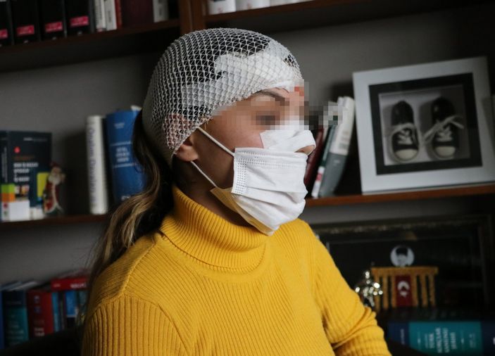 Adana'da eşi tarafından yüzü bıçakla kesilen kadın konuştu