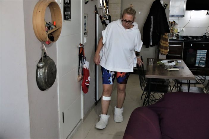 Antalya’da sokak köpeği tarafından ısırılan aşçı kadın kabusu yaşadı