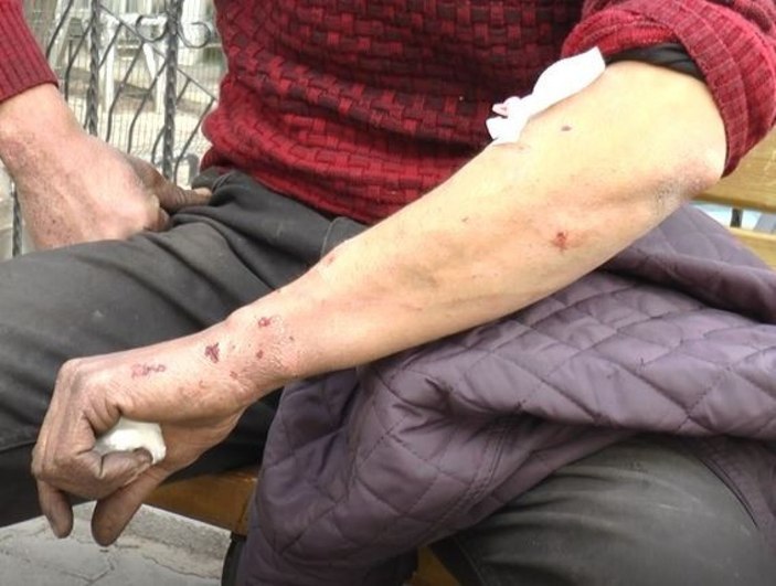 Gaziantep'te ikinci pitbull vakası