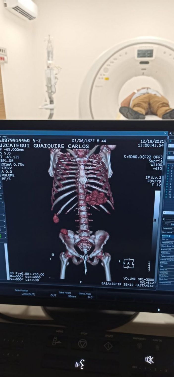 İstanbul Havalimanı'nda bir yolcunun midesinden 12 kapsül kokain çıkarıldı