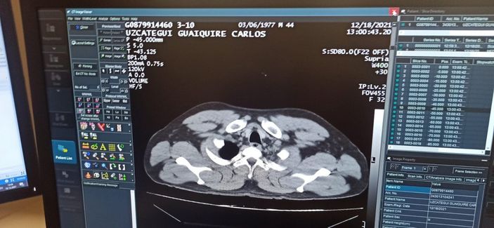 İstanbul Havalimanı'nda bir yolcunun midesinden 12 kapsül kokain çıkarıldı