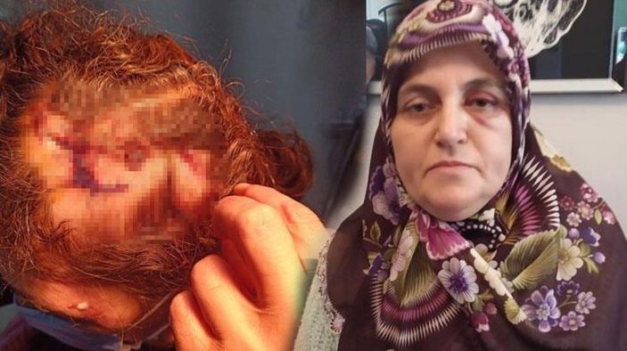 İstanbul'da komşusuna çekiçle saldıran kişi serbest bırakıldı