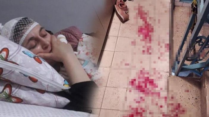 İstanbul'da komşusuna çekiçle saldıran kişi serbest bırakıldı