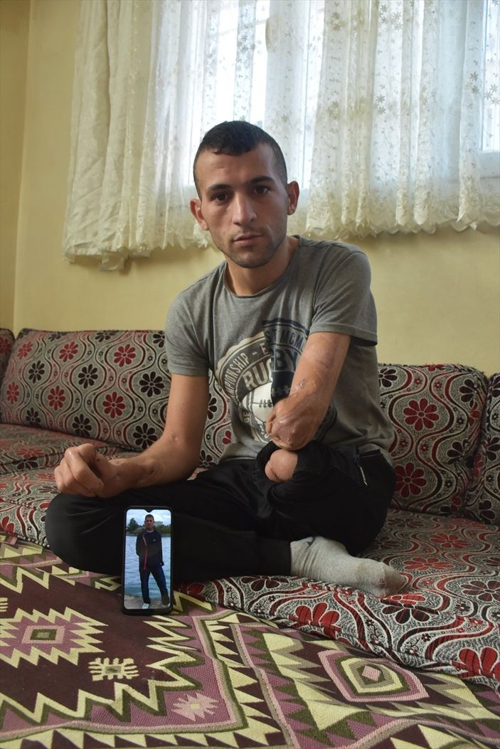a Adanalı genç, protez desteği bekliyor