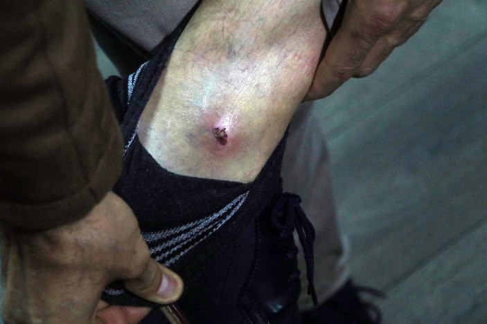 Adana’da veteriner hekime darp şüphelisi: İlk o vurdu