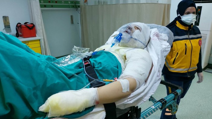 Ordu'da, eski eşini yanıcı maddeyle yakan adam: Borç verdim geri vermedi