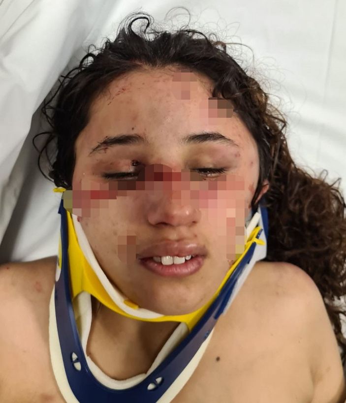 Adana'da 7 aylık hamile kadın, eşinin işkencesine maruz kaldı