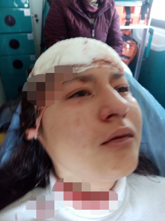 Kastamonu'da fotoğraf çeken genç kız 5 köpeğin saldırısına uğradı