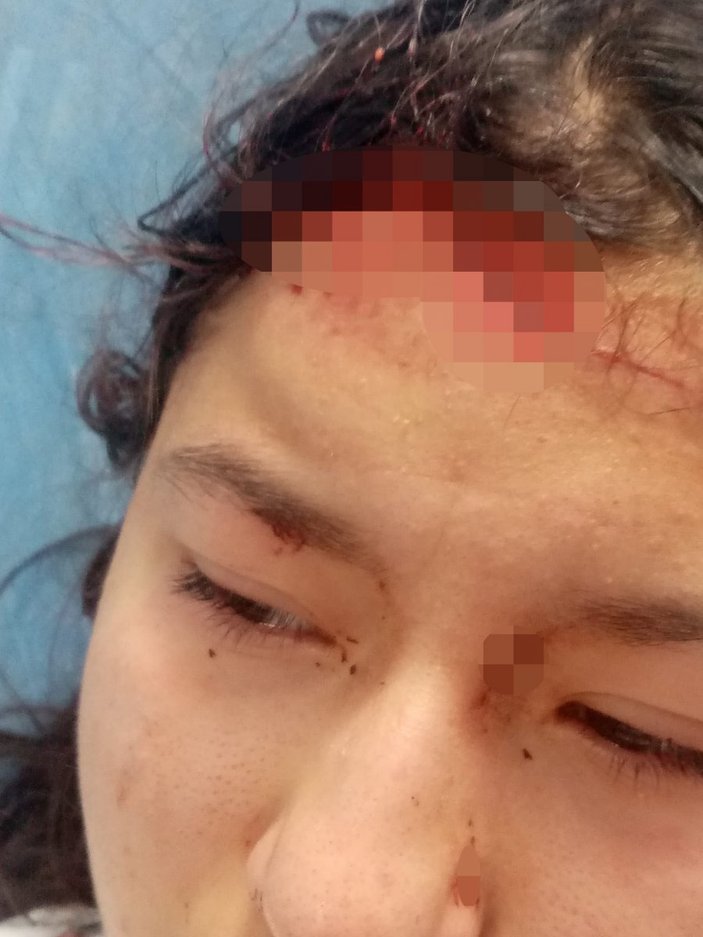 Kastamonu'da fotoğraf çeken genç kız 5 köpeğin saldırısına uğradı