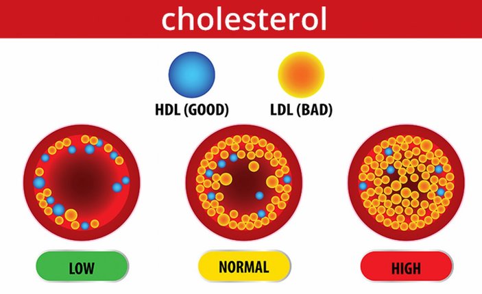 LDL kolesterol nedir