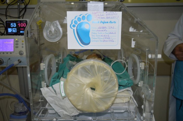 Erzincan’da, makatsız bebeğe 2,5 saatte makat yapıldı