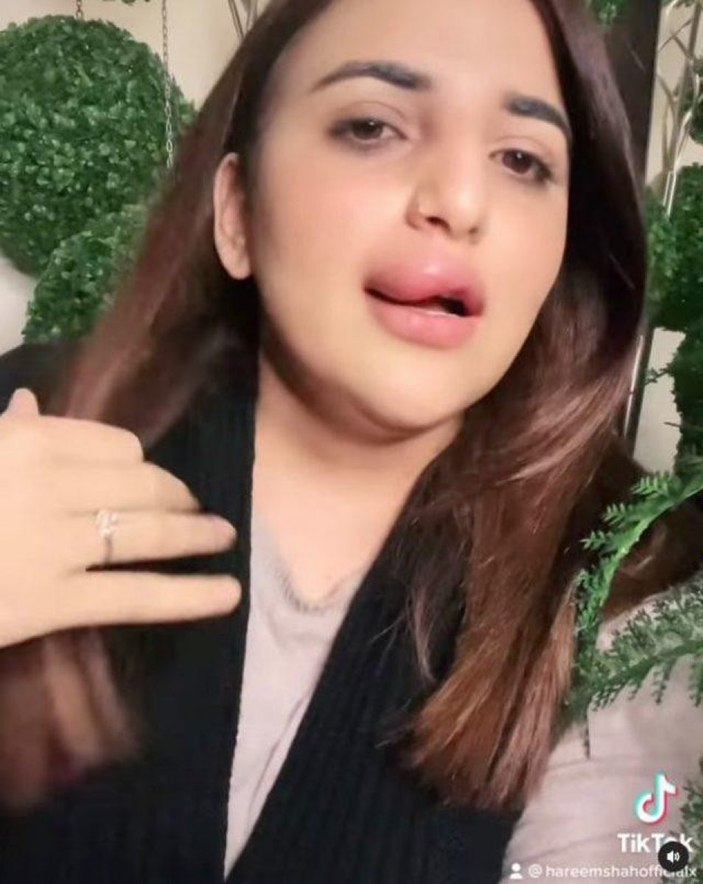 Yarıda kalan estetik! TikTok fenomeni son halini paylaştı...