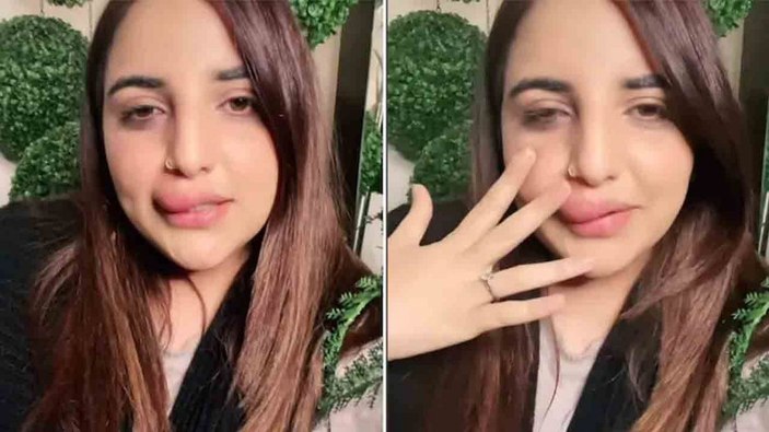 Yarıda kalan estetik! TikTok fenomeni son halini paylaştı...