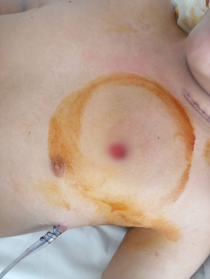 d Bursa'da satırla saldırı davası, ağır ceza mahkemesine gönderildi