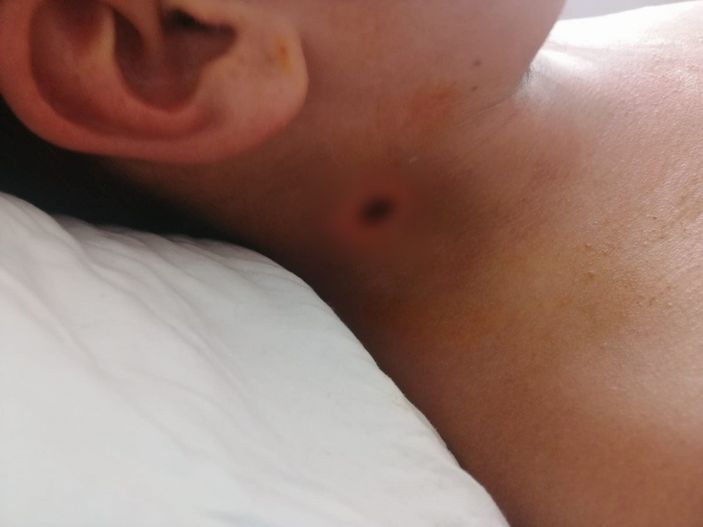 d Bursa'da satırla saldırı davası, ağır ceza mahkemesine gönderildi