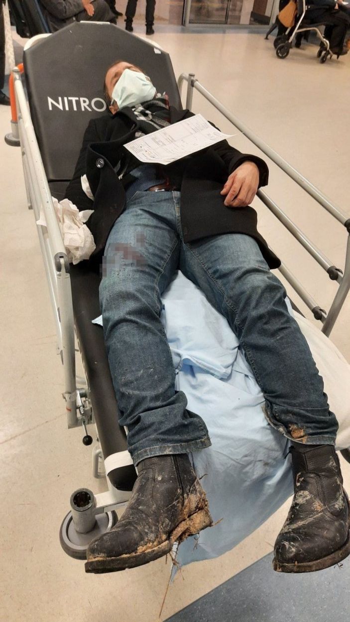 Ankara'da başıboş köpeklerin saldırısına uğrayan adam olay anını anlattı