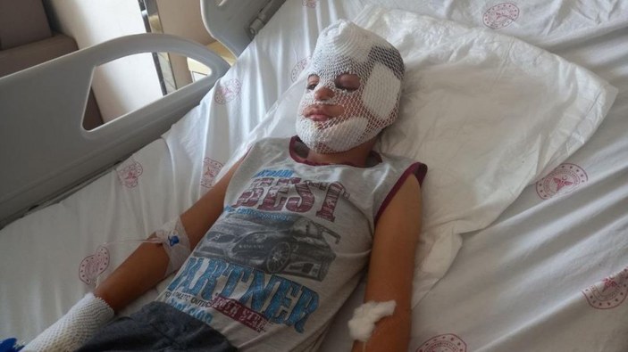 Mardin'de köpeklerin saldırısına uğrayan çocuk ağır yaralandı