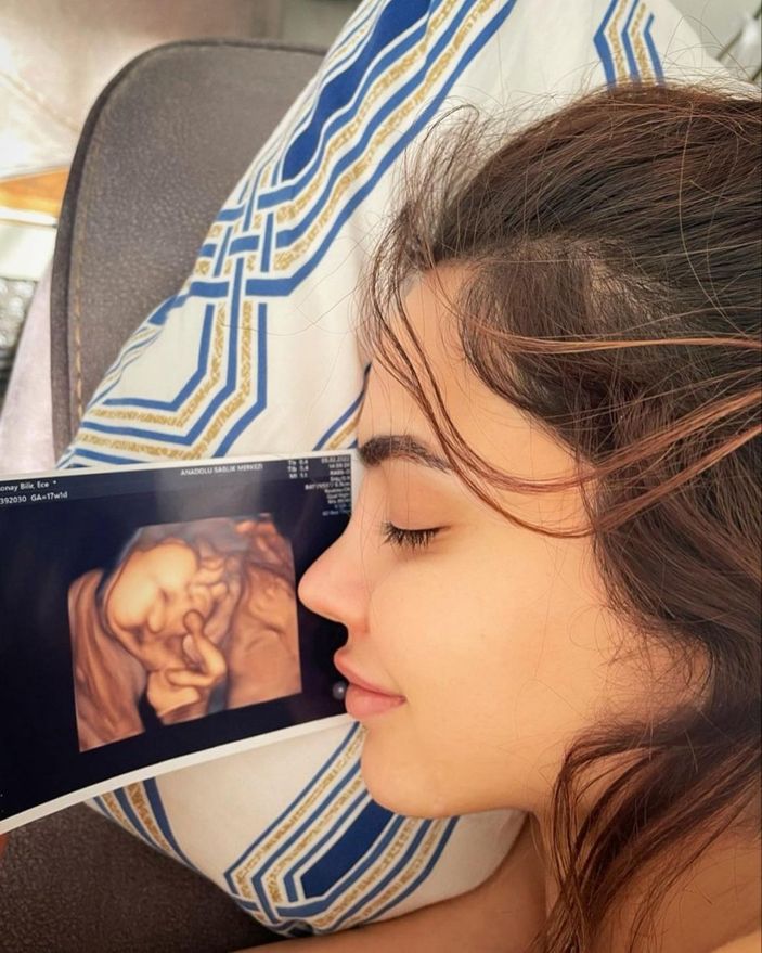 Mehmet Ali Erbil'i ifşalamıştı! Hamile olan Ece Ronay'dan karnı burnunda pozlar...