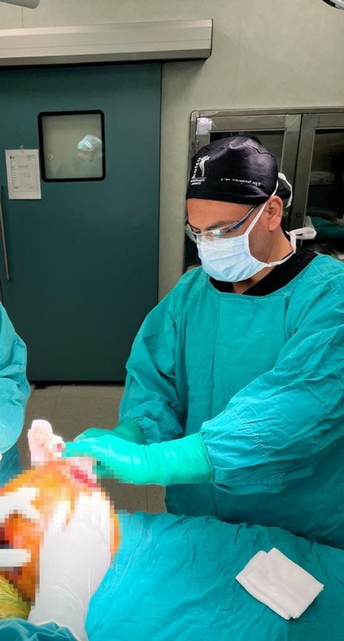 Şanlıurfa'da hastanın kalçasından 10 kilo tümör çıktı