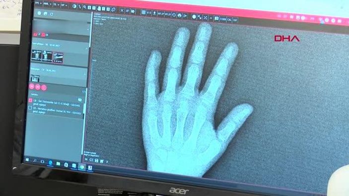 d Bilinçsiz kullanılan vitaminler ve takviyeler, çocukları hasta ediyor