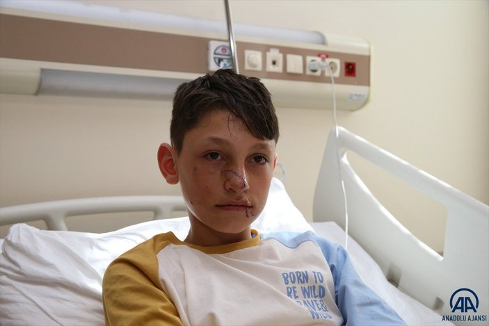 Tokat’ta köpek saldırısına uğrayan çocuk, ameliyattan çıktı