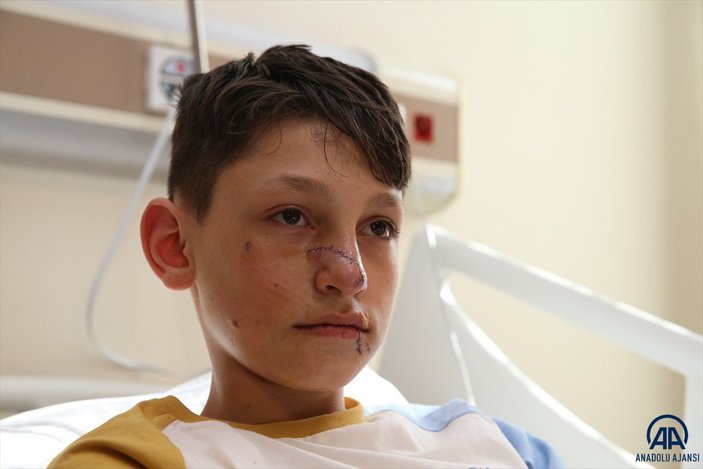 Tokat’ta köpek saldırısına uğrayan çocuk, ameliyattan çıktı
