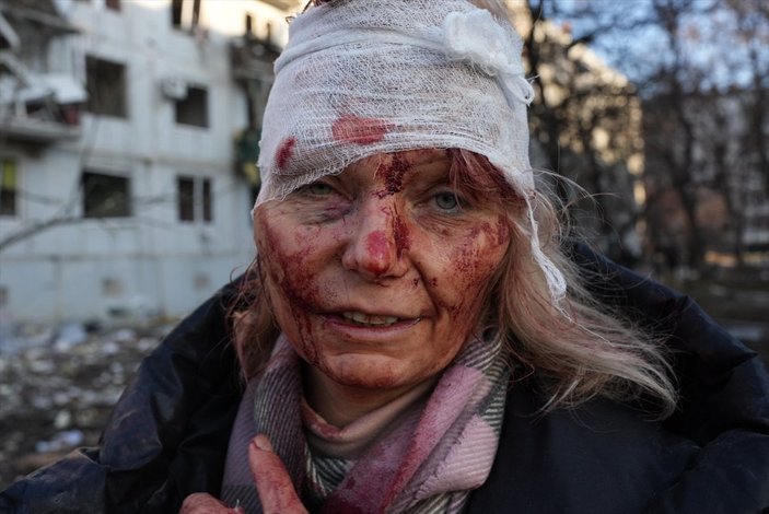 Ukrayna: Ölü ve yaralılar var