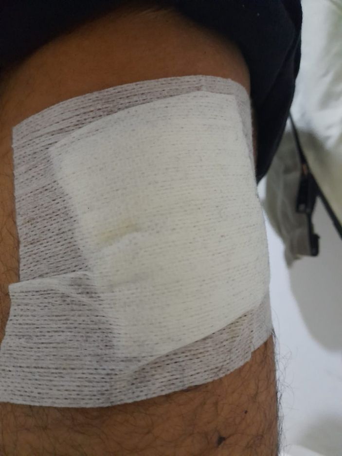 Antalya'da kendisini bıçaklayan şahısla polis merkezinde karşılaştı