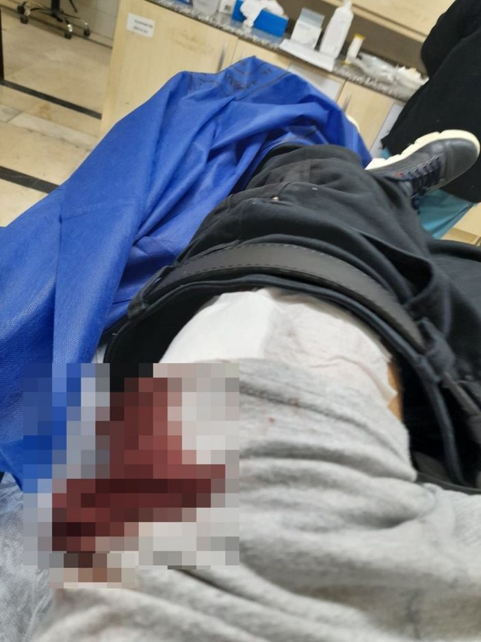 Antalya'da kendisini bıçaklayan şahısla polis merkezinde karşılaştı