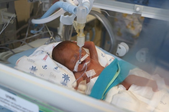 Tekirdağ'da 5,5 aylık doğan bebek kök hücreyle tedavi edildi
